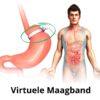 Virtuele-Maagband-